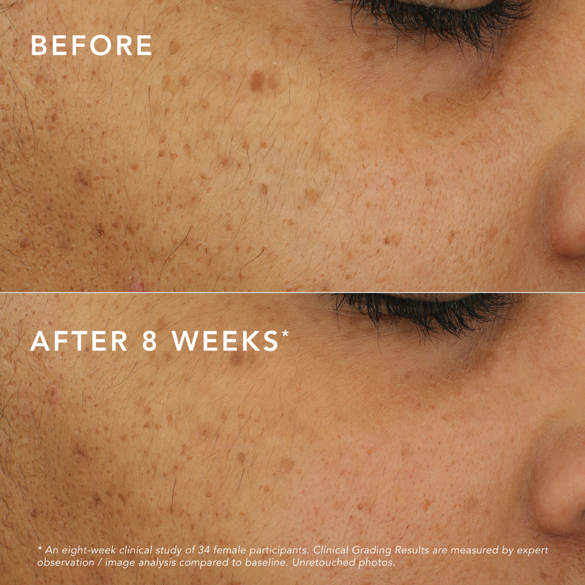 c-bright-dark-spot-corrector