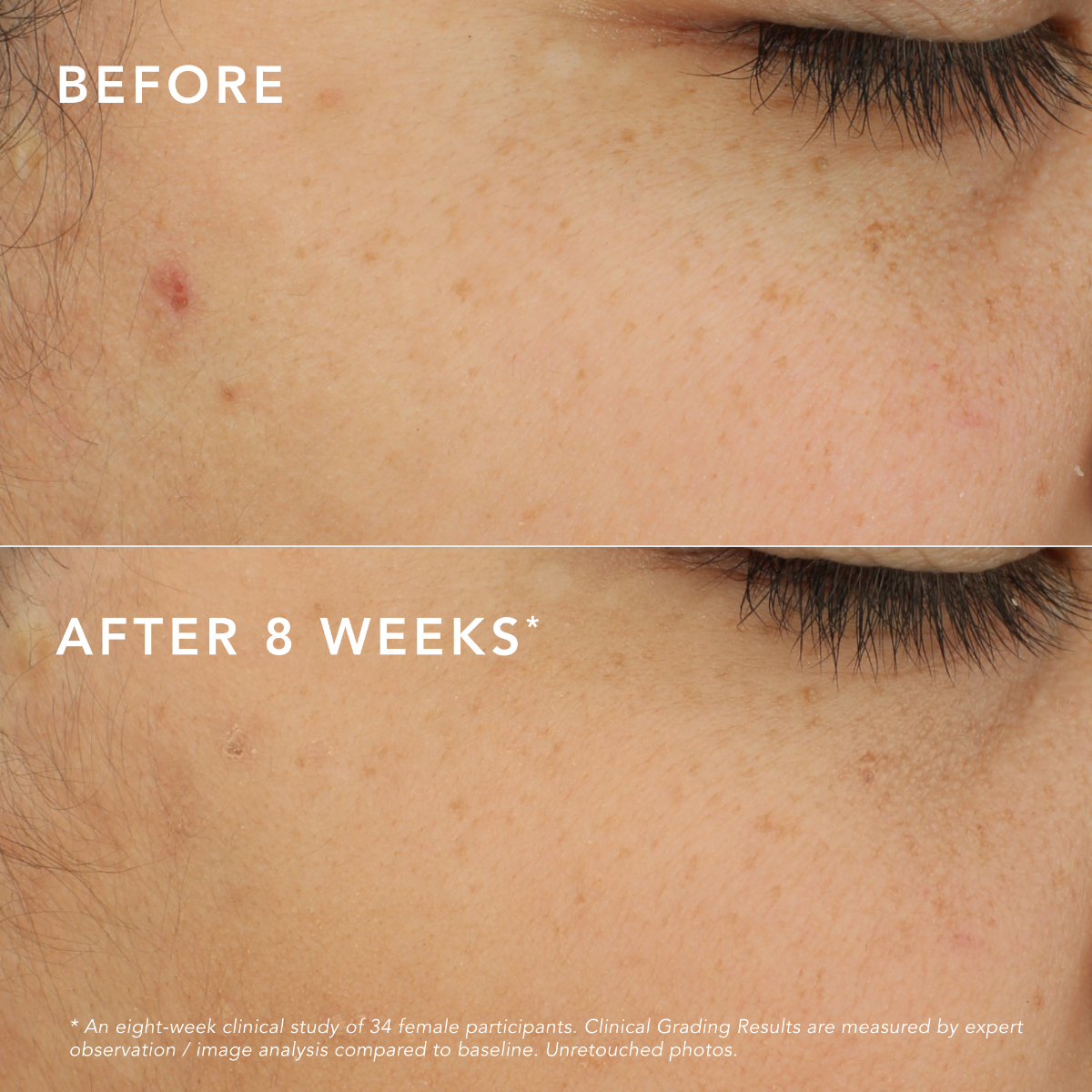 c-bright-dark-spot-corrector