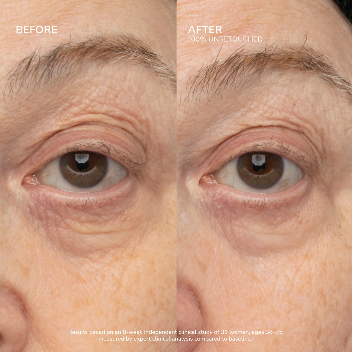 SeneCell™ SenePlex+® StemCell Concentrate