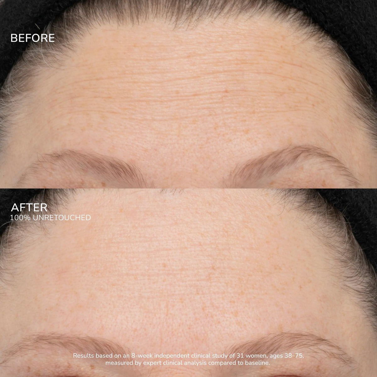 SeneCell™ SenePlex+® StemCell Concentrate